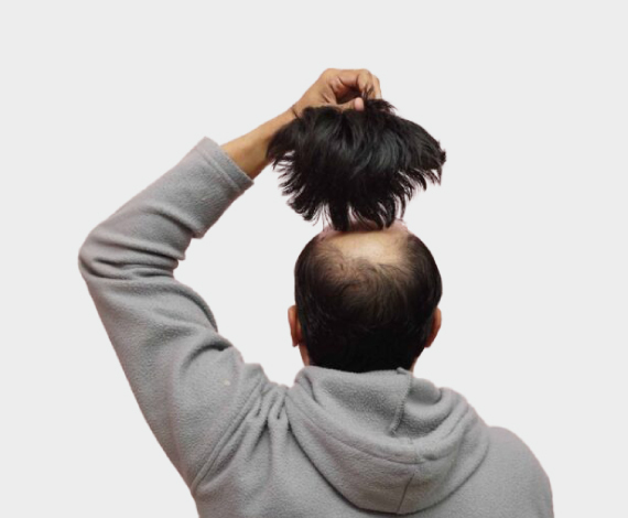 Look good instantly with Hair Fixing