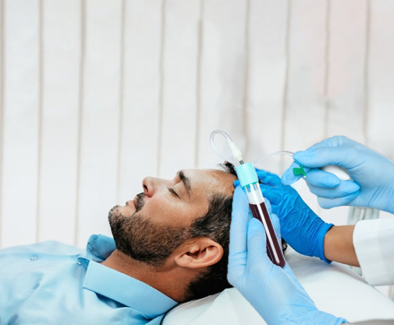 What is PRP treatment?