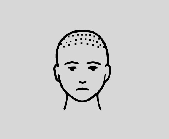 Immediately after the procedure