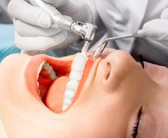 What is the difference between teeth whitening & teeth scaling & polishing?