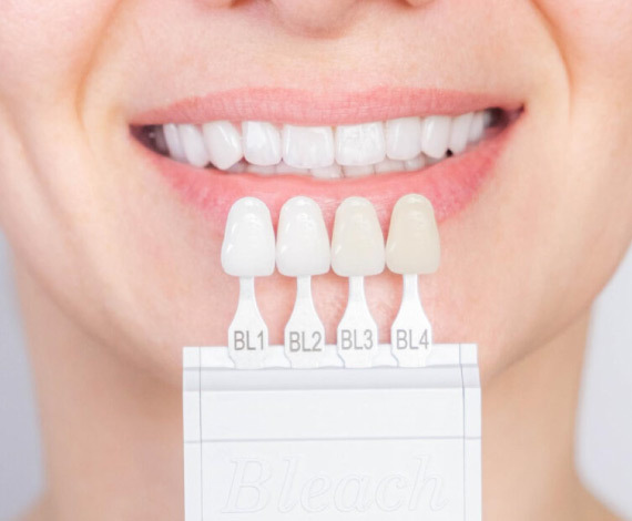 Is veneer good for teeth?