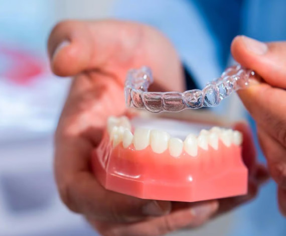 How long does it take for clear aligners to work?