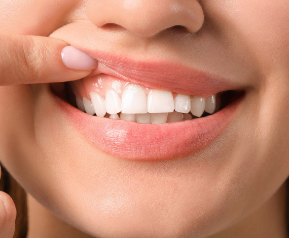 Benefits of Gum Depigmentation: