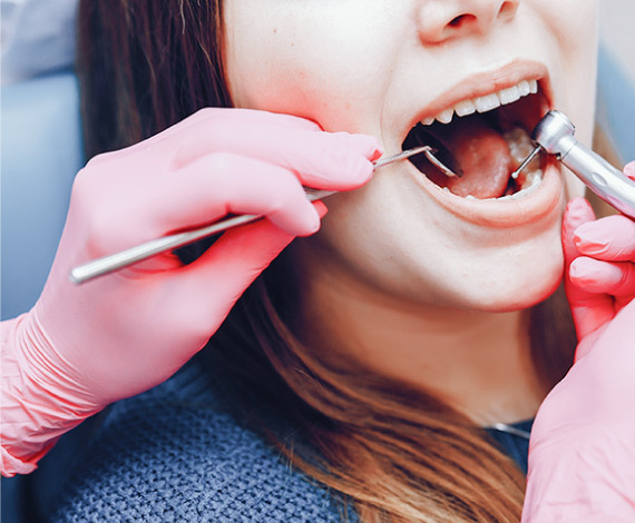 When should you go for root canal treatment?