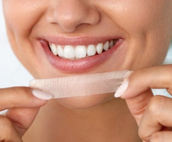 What should I keep in mind after undergoing teeth whitening treatment: