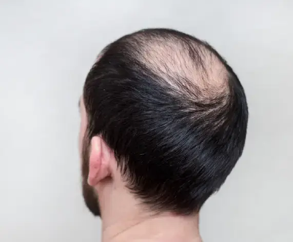 Reasons for QR678 Treatment