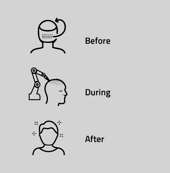 What to Expect Before, During & After the Procedure?